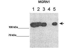 WB Suggested Anti-MGRN1 Antibody    Positive Control:  Lane 1: 10ug MGRN1-GFP transfected HEK293T Lane 2: 10ug mut1MGRN1-GFP transfected HEK293T Lane 3: 10ug mut1MGRN2-GFP transfected HEK293T Lane 4: 10ug GFP transfected HEK293T Lane 5: 10ug IP for GFP using lysate from lane 1   Primary Antibody Dilution :   1:1000   Secondary Antibody :  Goat anti rabbit-HRP   Secondry Antibody Dilution :   1:50,000  Submitted by:  Teresa Gunn, McLaughin Research Institute MGRN1 is supported by BioGPS gene expression data to be expressed in HEK293T (Mahogunin RING Finger Protein 1 anticorps  (Middle Region))