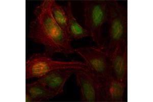 Immunofluorescence analysis of Hela cells using ZBTB7B mouse mAb (green). (ZBTB7B anticorps)
