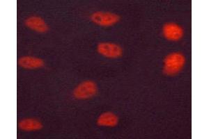 ABIN6267506 staining LOVO cells by ICC/IF.