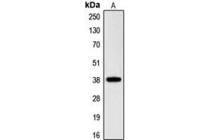 Western blot analysis of RNF197 expression in HeLa (A) whole cell lysates. (CGR19 anticorps  (C-Term))