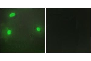 Immunofluorescence analysis of HeLa cells, using FEN1 antibody. (FEN1 anticorps)