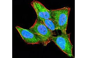 Immunocytochemistry (ICC) image for anti-Homeobox A9 (HOXA9) (AA 1-272) antibody (ABIN5868688) (HOXA9 anticorps  (AA 1-272))