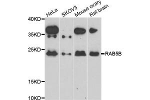 Western blot analysis of extracts of various cell lines, using RAB5B antibody (ABIN5975540) at 1/1000 dilution. (RAB5B anticorps)