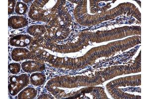 IHC-P Image ARL14 antibody [N1C3] detects ARL14 protein at cytoplasm and membrane in mouse duodenum by immunohistochemical analysis. (ARL14 anticorps  (full length))