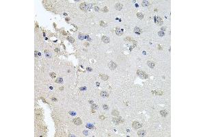 Immunohistochemistry of paraffin-embedded mouse brain using PKN1 antibody.