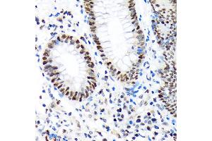 Immunohistochemistry of paraffin-embedded human appendix using PBRM1 Rabbit mAb (ABIN1512585, ABIN3020942, ABIN3020943 and ABIN7101308) at dilution of 1:100 (40x lens).