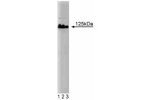 Western blot analysis of DNA Polymerase delta on Jurkat lysate. (POLD1 anticorps  (AA 60-261))