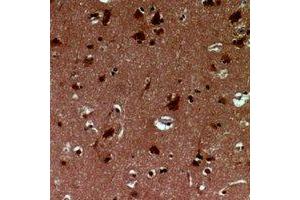 Immunohistochemical analysis of EID1 staining in human brain formalin fixed paraffin embedded tissue section. (EID1 anticorps)