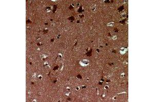 Immunohistochemical analysis of EID1 staining in human brain formalin fixed paraffin embedded tissue section.
