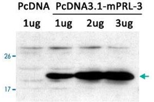 Western blot analysis of extracts from LX-2 cells transfected with PTP4A3 using PTP4A3 polyclonal antibody . (PTP4A3 anticorps  (AA 161-166))