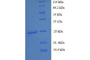 SDS-PAGE (SDS) image for Solute Carrier Family 26, Member 3 (SLC26A3) (AA 814-1011), (partial) protein (His tag) (ABIN5713112)