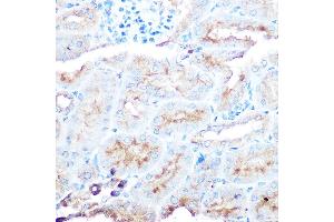 Immunohistochemistry of paraffin-embedded human liver using ZIP14 Rabbit pAb (ABIN6133191, ABIN6147993, ABIN6147994 and ABIN6214658) at dilution of 1:50 (40x lens). (SLC39A14 anticorps  (AA 240-340))