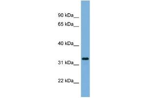 WB Suggested Anti-PEX11A  Antibody Titration: 0. (PEX11A anticorps  (N-Term))