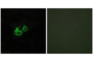 Immunofluorescence (IF) image for anti-Growth Hormone Releasing Hormone Receptor (GHRHR) (C-Term) antibody (ABIN1852965) (GHRHR anticorps  (C-Term))