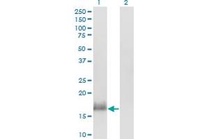 Western Blot analysis of CALML3 expression in transfected 293T cell line by CALML3 monoclonal antibody (M04), clone 2A11. (CALML3 anticorps  (AA 1-149))