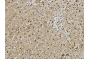 Immunoperoxidase of monoclonal antibody to GSTA1 on formalin-fixed paraffin-embedded human liver. (GSTA1 anticorps  (AA 1-222))