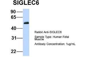 Host:  Rabbit  Target Name:  SIGLEC6  Sample Type:  Human Fetal Muscle  Antibody Dilution:  1. (SIGLEC6 anticorps  (N-Term))