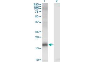 Western Blot analysis of JARID1A expression in transfected 293T cell line by JARID1A monoclonal antibody (M03), clone 1H2. (KDM5A anticorps  (AA 191-290))