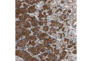 Immunohistochemical staining (Formalin-fixed paraffin-embedded sections) of human stomach with PI4KB polyclonal antibody  shows strong cytoplasmic positivity in glandular cells.