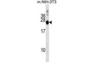 Western Blotting (WB) image for anti-DnaJ (Hsp40) Homolog, Subfamily C, Member 5 (DNAJC5) antibody (ABIN2999623) (DNAJC5 anticorps)