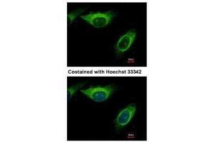 ICC/IF Image Immunofluorescence analysis of methanol-fixed HeLa, using MEK2, antibody at 1:500 dilution.