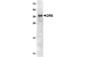 Western Blotting (WB) image for Tumor Necrosis Factor Receptor Superfamily, Member 21 (TNFRSF21) (AA 42-349), (Extracellular Domain) protein (His tag) (ABIN2468353)