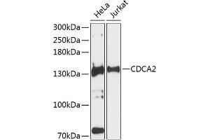 Western blot analysis of extracts of various cell lines, using CDC antibody (ABIN6131118, ABIN6138269, ABIN6138270 and ABIN6224963) at 1:3000 dilution. (CDCA2 anticorps  (AA 724-1023))