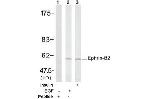 Image no. 1 for anti-Ephrin B2 (EFNB2) (Tyr316) antibody (ABIN197416) (Ephrin B2 anticorps  (Tyr316))