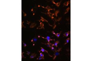 anti-Amphiphysin (AMPH) (AA 340-620) antibody