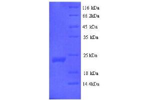 SDS-PAGE (SDS) image for Vascular Endothelial Growth Factor B (VEGFB) (AA 22-207) protein (His tag) (ABIN5713938)