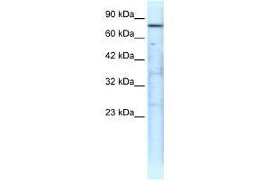 WB Suggested Anti-TRAP1 Antibody Titration: 0. (TRAP1 anticorps  (N-Term))