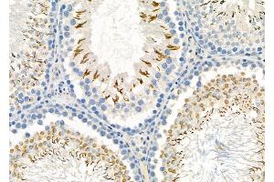 ABIN6265308 and ABIN6273168 at 1/100 staining Rat testis tissue by IHC-P. (Stanniocalcin 2 anticorps  (C-Term))