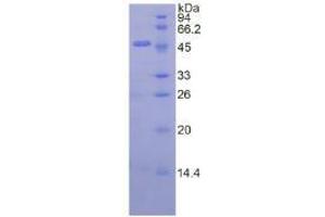 SDS-PAGE analysis of Pig Interferon beta Protein. (IFNB1 Protéine)