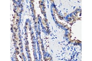 Immunohistochemistry of paraffin-embedded Rat lung using SCGB1A1 Polyclonal Antibody at dilution of 1:100 (40x lens). (SCGB1A1 anticorps)