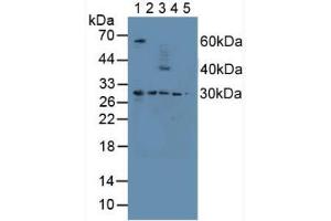 Figure. (Proteasome 26S Subunit, Non ATPase 9 (AA 2-223) anticorps)