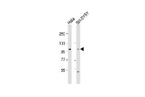 All lanes : Anti-ADCY5 Antibody (Center) at 1:1000-1:2000 dilution Lane 1: Hela whole cell lysate Lane 2: SH-SY5Y whole cell lysate Lysates/proteins at 20 μg per lane. (ADCY5 anticorps  (AA 604-639))