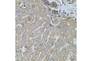 Immunohistochemistry of paraffin-embedded human liver injury using FLNB antibody.