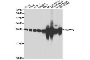 Western blot analysis of extracts of various cell lines, using NDUFV2 antibody. (NDUFV2 anticorps)