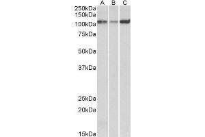 ABIN1686784 (0. (ATP2A2 anticorps  (Internal Region))