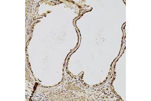 Immunohistochemistry of paraffin-embedded human prostate using FGF2 antibody (ABIN1872685) at dilution of 1:100 (20x lens). (FGF2 anticorps)