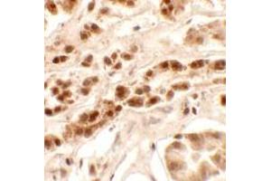 Immunohistochemistry (IHC) image for anti-Patched Domain Containing 2 (PTCHD2) (Middle Region) antibody (ABIN1031050) (PTCHD2 anticorps  (Middle Region))