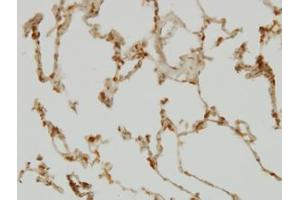 Image no. 4 for anti-SH2 Domain Containing 4A (SH2D4A) (AA 239-338) antibody (ABIN599292) (SH2D4A anticorps  (AA 239-338))