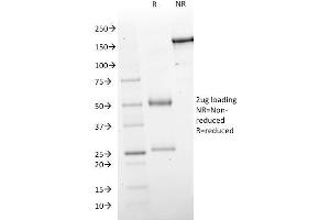 SDS-PAGE Analysis Purified GAD1 (GAD67) Mouse Monoclonal Antibody (GAD1/2563). (GAD anticorps  (AA 72-135))