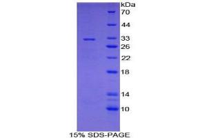 SDS-PAGE analysis of Mouse CYP7A1 Protein.