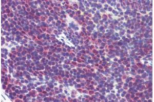 Mouse spleen: Formalin-Fixed, Paraffin-Embedded (FFPE)