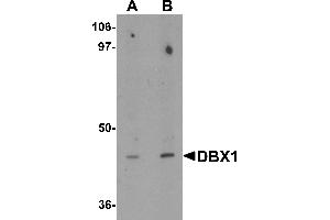 Western blot analysis of DBX1 in mouse kidney tissue lysate with DBX1 antibody at (A) 1 and (B) 2 µg/mL. (DBX1 anticorps  (Middle Region))