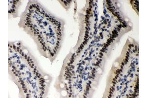 Anti- CSNK1A1 Picoband antibody,IHC(P) IHC(P): Mouse Intestine Tissue (CSNK1A1 anticorps  (N-Term))