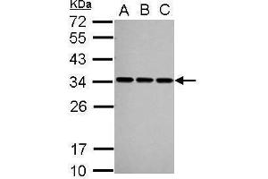 WB Image Sample (30 ug of whole cell lysate) A: A549 B: HeLa C: HepG2 12% SDS PAGE antibody diluted at 1:1000 (SNRPA1 anticorps  (C-Term))