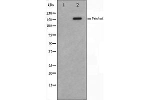 Western blot analysis of Patched expression in mouse muscle cells,The lane on the left is treated with the antigen-specific peptide. (Patched 1 anticorps)