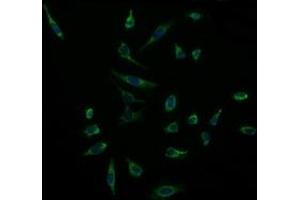 Immunofluorescence (IF) image for anti-Acetyl-CoA Acyltransferase 2 (ACAA2) antibody (ABIN1495726)
